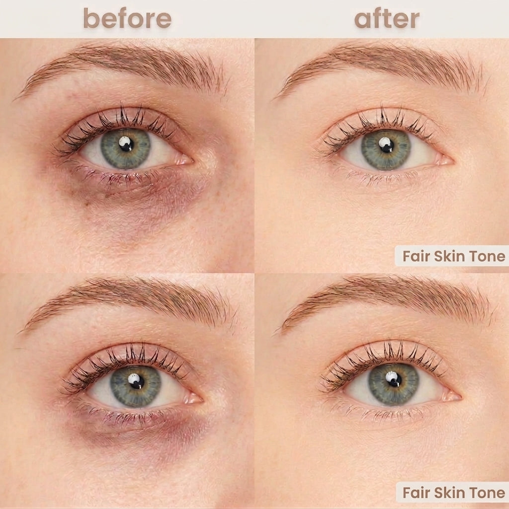 Undereye Corrector