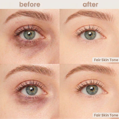 Undereye Corrector