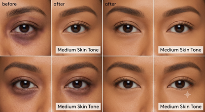 Undereye Corrector